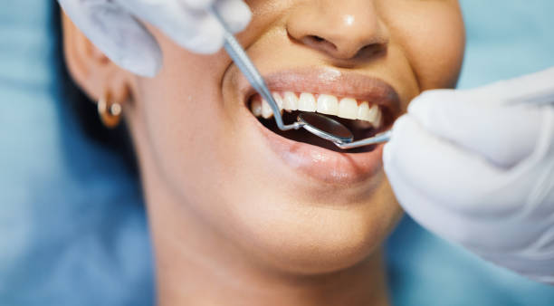 Best Broken or Chipped Tooth Repair in St Leo, FL